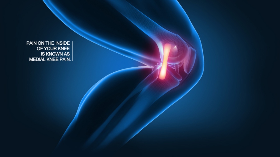 knee brace for arthritis